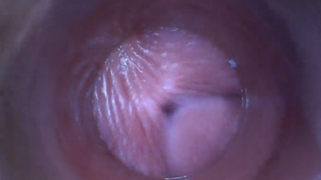 Abspritzen fotze Fotze spritzen: