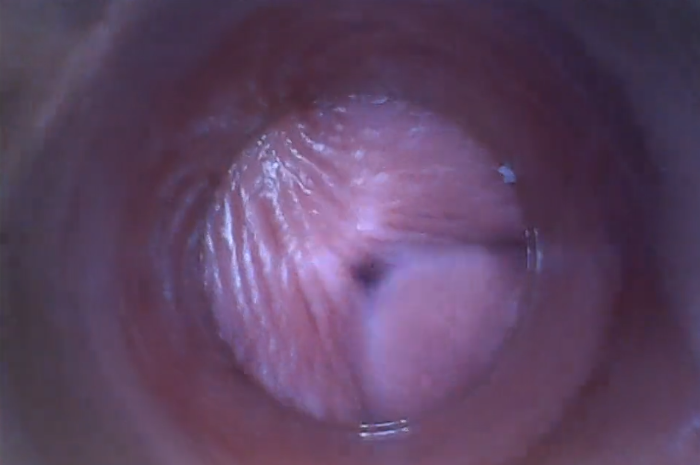 Kamera in der vagina